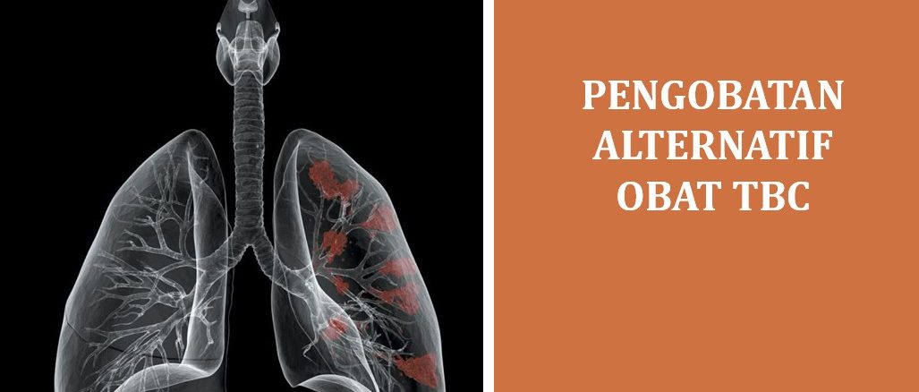 Pengobatan Alternatif Obat TBC