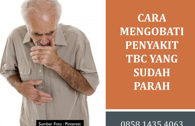 Cara Mengobati Penyakit TBC yang Sudah Parah