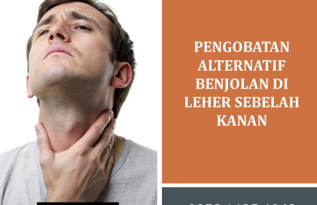 Pengobatan Alternatif Benjolan di Leher Sebelah Kanan