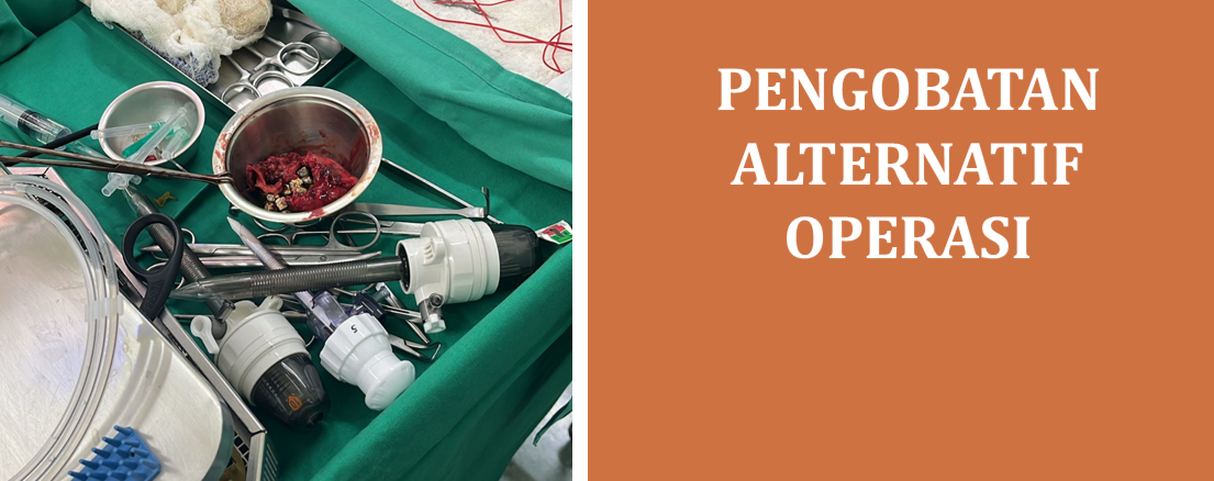 Pengobatan Alternatif Operasi