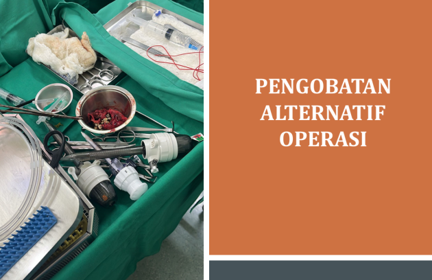Pengobatan Alternatif Operasi