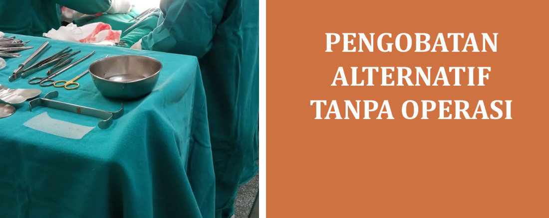 Pengobatan Alternatif tanpa Operasi