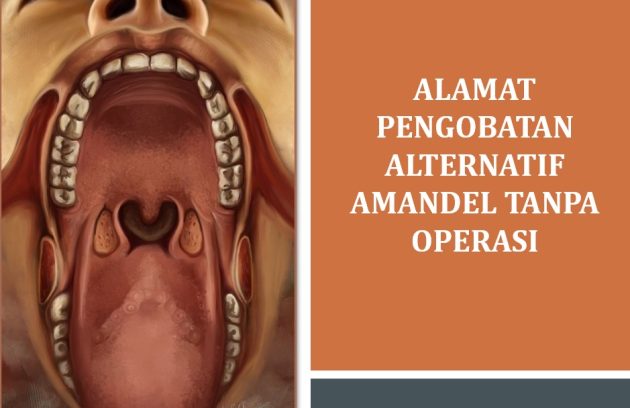 Alamat Pengobatan Alternatif Amandel Tanpa Operasi