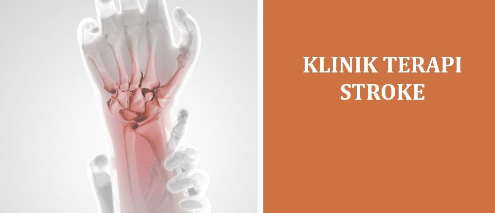 Klinik Terapi Stroke di Jakarta