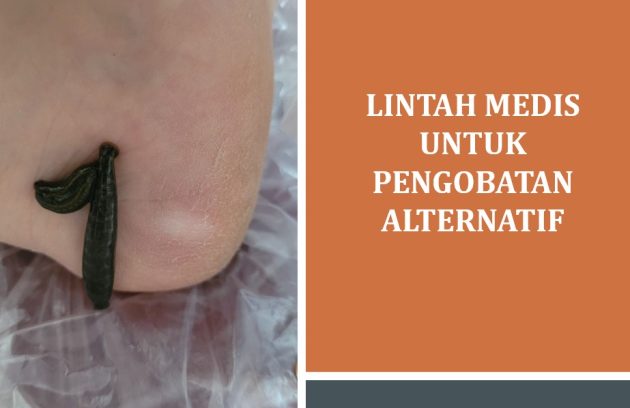 Lintah Medis untuk Pengobatan Alternatif