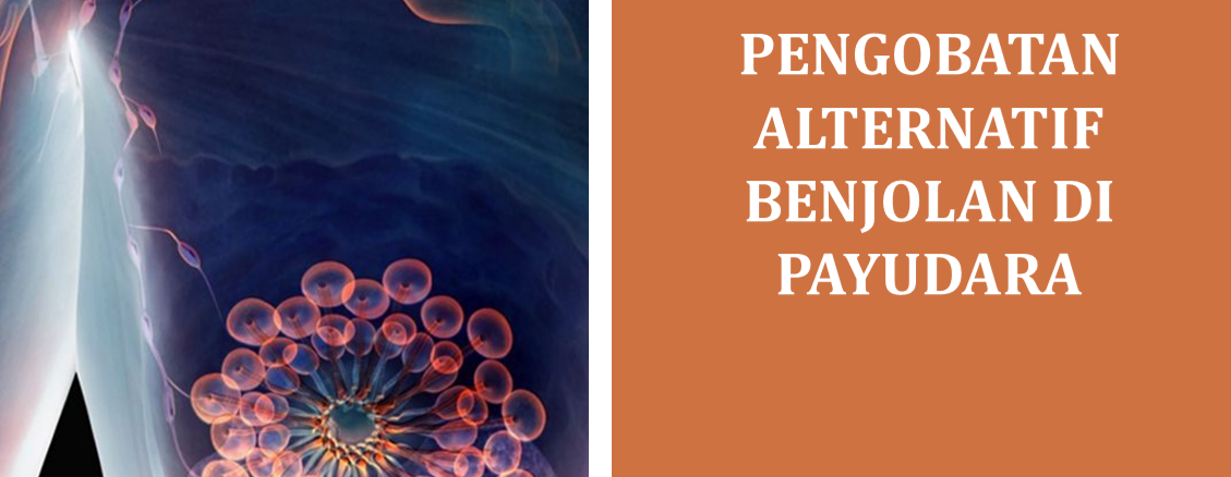 Pengobatan Alternatif Benjolan di Payudara