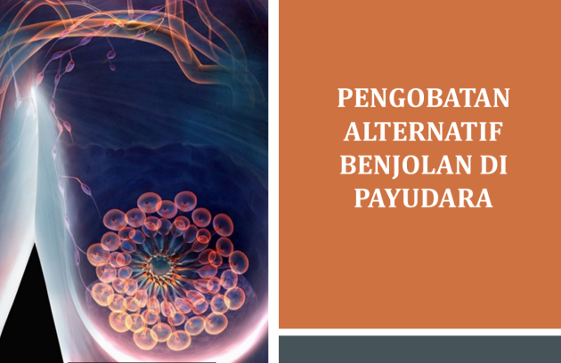 Pengobatan Alternatif Benjolan di Payudara