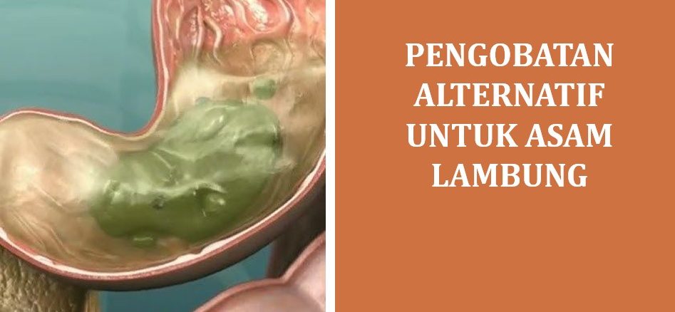 Pengobatan Alternatif untuk Asam Lambung