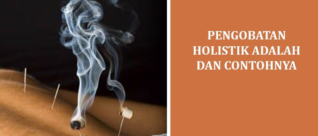 Pengobatan Holistik adalah dan Contohnya