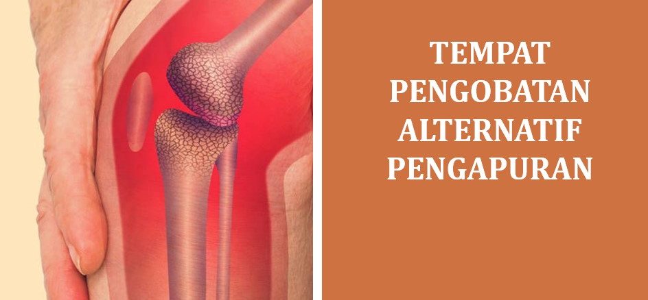 Tempat Pengobatan Alternatif Pengapuran