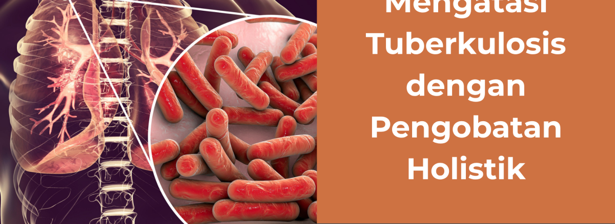 Mengatasi Tuberkolosis dengan pengobatan holistik