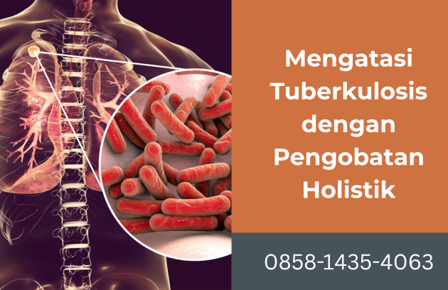 Mengatasi Tuberkolosis dengan pengobatan holistik